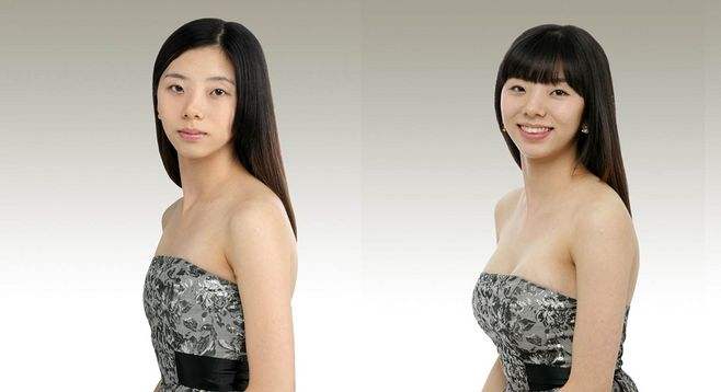 胸部整形多少錢？